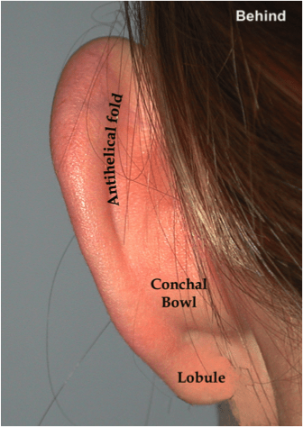 Otoplasty (Ear Pinning) | Dr Jason Roth | Sydney