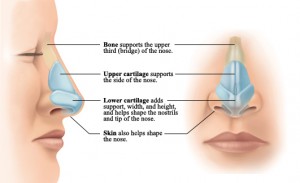 Broken Nose Surgery