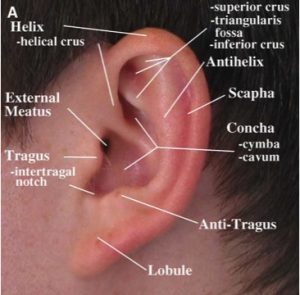 Otoplasty (ear pinning)